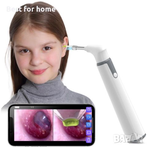 Професионален смарт отоскоп ScopeAround Otoscope Ear Camera, WiFi, снимка 10 - Уреди за диагностика - 46643431