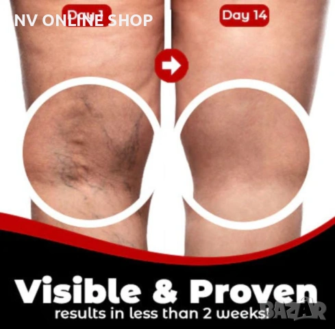 Пастири за лечение на разширени вени Varicose Care Health Patch 12бр, снимка 2 - Други - 53183431