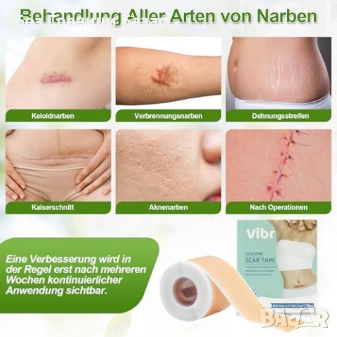 Нов Силиконов комплект за белези – лента и лепенки 4x15см, 4x150см, снимка 4 - Други - 52134678