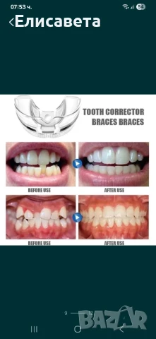 Ортодонтски коректор за зъби, снимка 4 - Козметика за лице - 51162870
