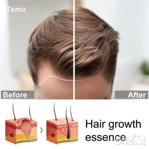 Многофункционален продукт за коса – растеж, заздравяване и сгъстяване, снимка 10 - Продукти за коса - 45686281
