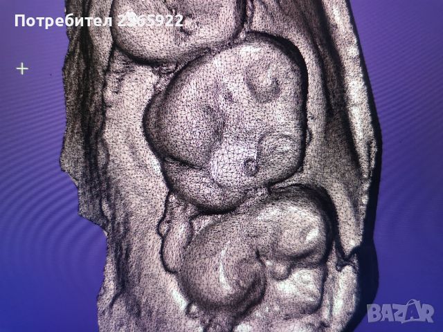 3д скенер Sirona ineos blue , снимка 7 - Лаборатория - 46056968