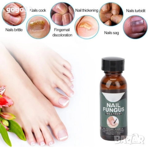 лак против гъбички , снимка 14 - Други - 51861216