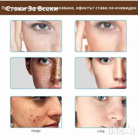 Оризов крем за лице Mixia Rice Pretty против акне и петна, снимка 5 - Козметика за лице - 54254944