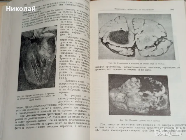 Практическо ръководство по патологична анатомия, снимка 8 - Специализирана литература - 47939659