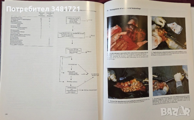 Голям атлас на колоректалната хирургия / A Colour Atlas of Colorectal Surgery, снимка 13 - Специализирана литература - 53748180