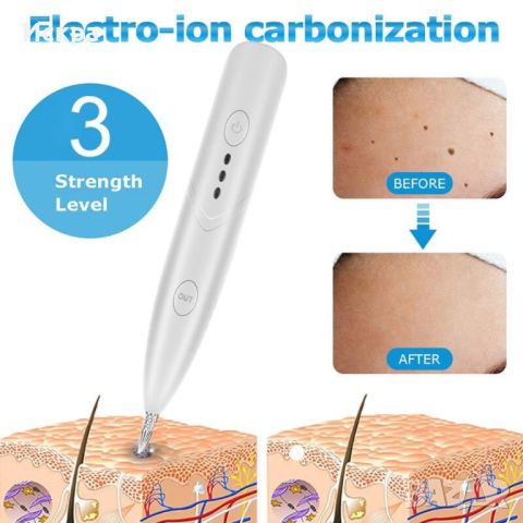 Лазерна машинка за премахване на петна, бенки, брадавици и татуировки с USB, снимка 9 - Други - 45852551