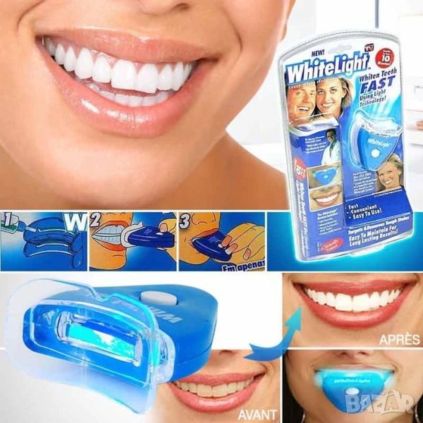 🦷 Домашно избелване на зъби с White Light S56 💡 , снимка 1