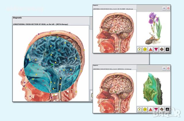 Биорезонансен Апарат за Диагностика и Лечение Metatron Hunter 4025 NLS, снимка 8 - Друга електроника - 46234305