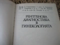 Рентгенова диагностика в гинекологията, снимка 3