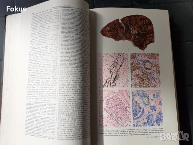 БОЛЬШАЯ МЕДИЦИНСКАЯ ЕНЦИКЛОПЕДИЯ, снимка 5 - Антикварни и старинни предмети - 53486963