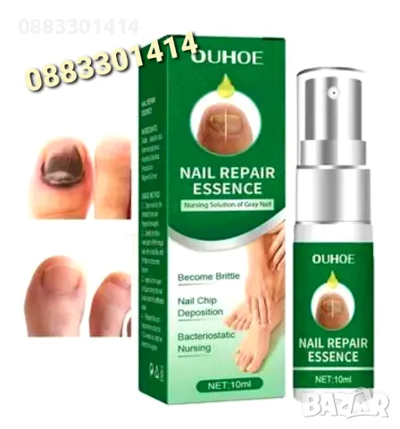 Спрей за нокти Премахва гъбички на ноктите , снимка 3 - Продукти за маникюр - 50094300