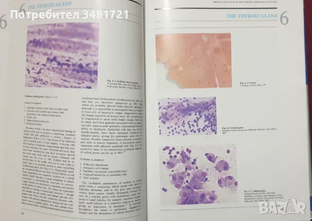 Атлас и наръчник по аспирационна цитология /Manual and Atlas of Fine Needle Aspiration Cytology, снимка 9 - Специализирана литература - 47891625