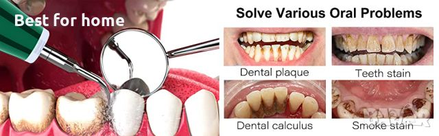 Комплект за почистване на зъби и зъбен камък LB1, снимка 2 - Стоматология - 46562742