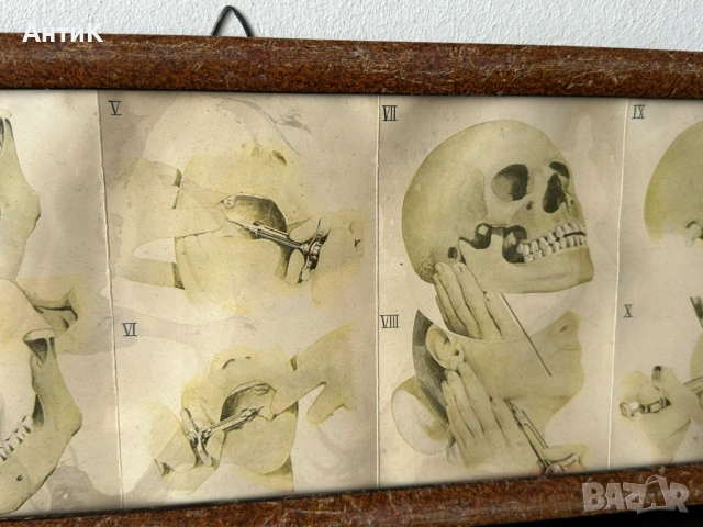 Медицинско Табло Брошура BAYER , снимка 5 - Антикварни и старинни предмети - 54249688