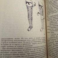 Разширени вени на долните крайници -Димитър Хаджиев,1977,стр.75, снимка 6 - Специализирана литература - 45384576