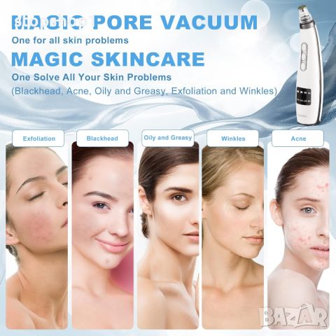 Vacuum blackhead remover премахване на черни точки, USB акумулаторен екстрактор на пъпки Tibobo, снимка 3 - Други - 46673685