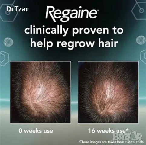 Regaine 5% Minoxidil 5% Foam for men / Регаин 5% Миноксидил 5% Пяна за мъже, снимка 4 - Продукти за коса - 47415751