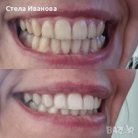 Паста за избелване на зъбите Extra white pro, снимка 1 - Други - 45170763