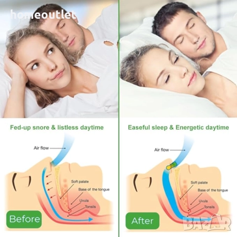 ПРОМОЦИЯ Магнитно устройство против хъркане – ефективно и удобно решение за по-добър сън X0015RSMN7, снимка 5 - Други - 51653312