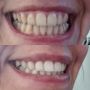 Паста за избелване на зъбите Extra white pro