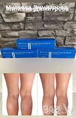 ХИРУДОИД ФОРТЕ КРЕМ - ефективен гел при разширени вени