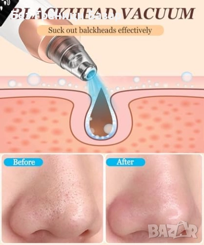 Нов уред Премахвач на черни точки с вакуумна технология 5 сменяеми глави, снимка 2 - Други - 51676852