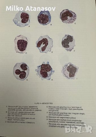 Хематологичен Атлас-The Morphology of Human Blood Cells-Abbot laboratories,1985,p.92, снимка 6 - Специализирана литература - 45372137