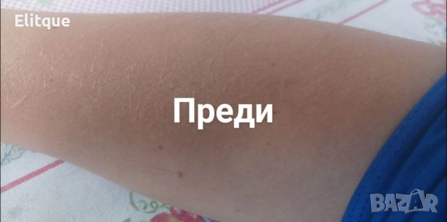 Компактен кристален уред за премахване на излишното окосмяване , снимка 4 - Други - 52796081