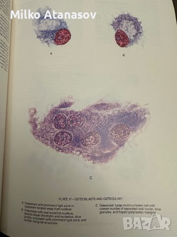 Хематологичен Атлас-The Morphology of Human Blood Cells-Abbot laboratories,1985,p.92, снимка 10 - Специализирана литература - 45372137
