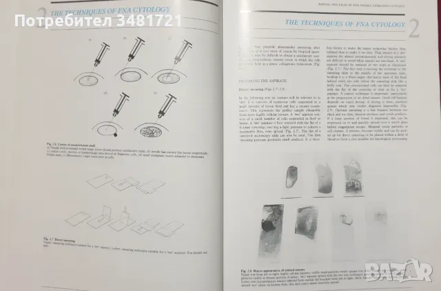 Атлас и наръчник по аспирационна цитология /Manual and Atlas of Fine Needle Aspiration Cytology, снимка 5 - Специализирана литература - 47891625