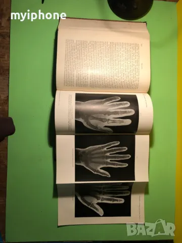 Стара Книга Болести на Обмяната Болести на Жлезите с Вътрешна секреция, снимка 11 - Специализирана литература - 49204935