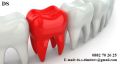 Зъботехнически услуги, снимка 1 - Медицински, стоматологични - 41563450