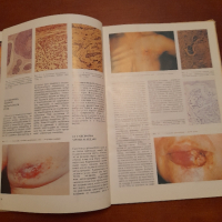 Атлас по кожни болести, снимка 5 - Специализирана литература - 44958324