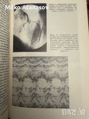 Кардиомиопатии-Е.Маламов,К.Чичовски, снимка 6 - Специализирана литература - 45252364