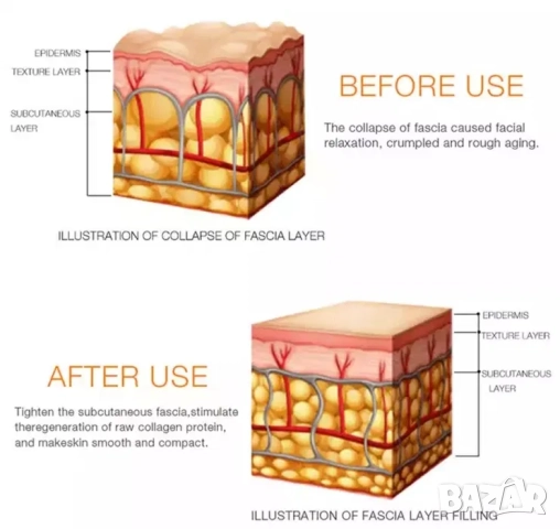 Мини HIFU дълбок лифтинг с RF и LED светлини за бръчки, снимка 6 - Козметични уреди - 52165283