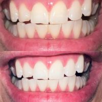 Паста за избелване на зъбите Extra white pro, снимка 3 - Други - 45170763