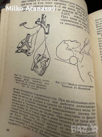 Новокаинът в съвременната терапия -В.Янчев,1963,стр.211, снимка 4 - Специализирана литература - 45304720