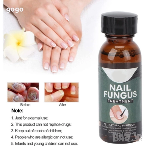 лак против гъбички , снимка 13 - Други - 51861216