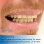 Instant Smile Lowers усмивка за минути - комплект от горни и долни зъби, снимка 4