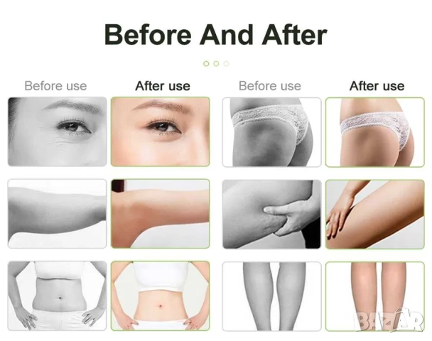 Уред за кавитация , радиочестотен лифтинг и вакуум 4 в 1, снимка 11 - Козметични уреди - 52061982