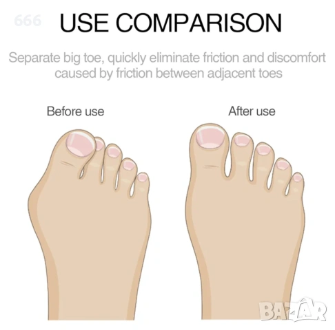 Силиконов разделител за пръсти тип "чукче", снимка 4 - Други - 53865713