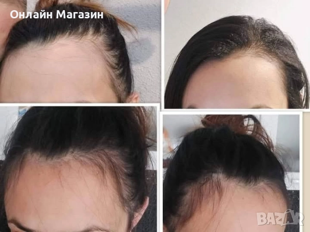 ЕКСКЛУЗИВНО – сега получаваш маската от комплекта като подарък 🎁 Вземи серията BioRehab с 36.90 лв , снимка 5 - Продукти за коса - 52003042