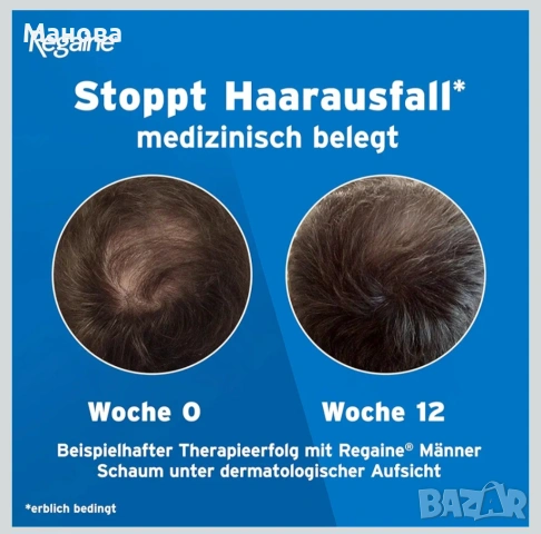 Regaine миноксидил 5% пяна против оплешивяване и косопад, снимка 2 - Продукти за коса - 53956369