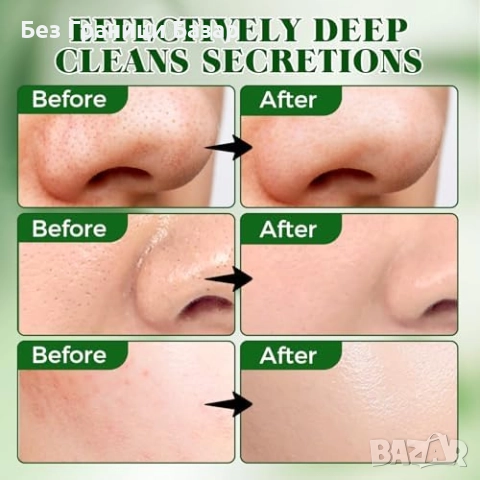 Нови Ленти за черни точки с активен въглен 80 броя дълбоко почистване, снимка 2 - Козметика за лице - 52155937