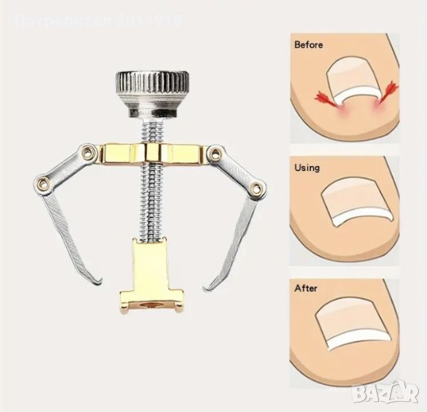 Инструмент за врастнали нокти, снимка 1