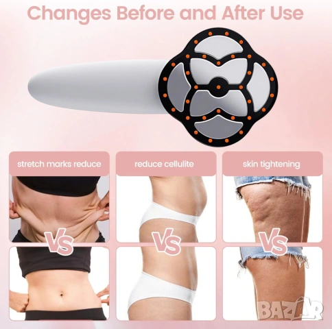 Антицелулитен масажор - Fat Burning Iron, снимка 6 - Масажори - 53446842