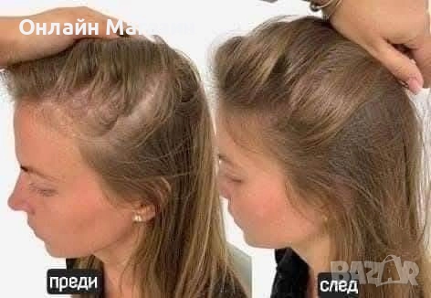 ЕКСКЛУЗИВНО – сега получаваш маската от комплекта като подарък 🎁 Вземи серията BioRehab с 36.90 лв , снимка 3 - Продукти за коса - 52003042