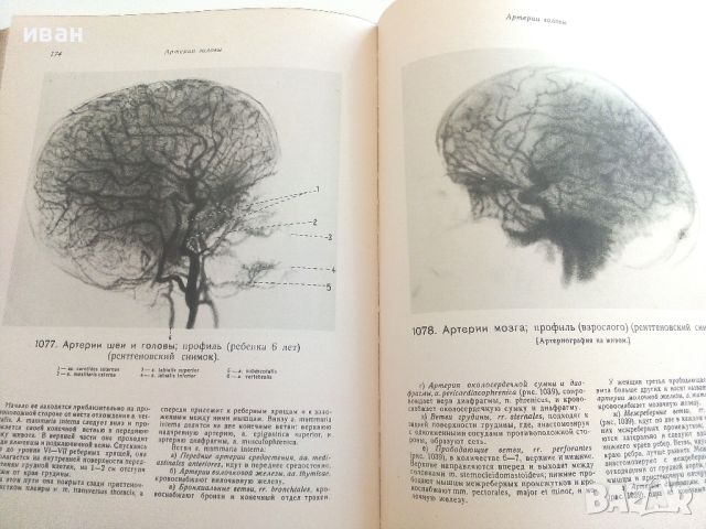Атлас анатомии Человека  Том 4- В.Воробьев,Р..Синельников -1948г., снимка 6 - Специализирана литература - 36875790