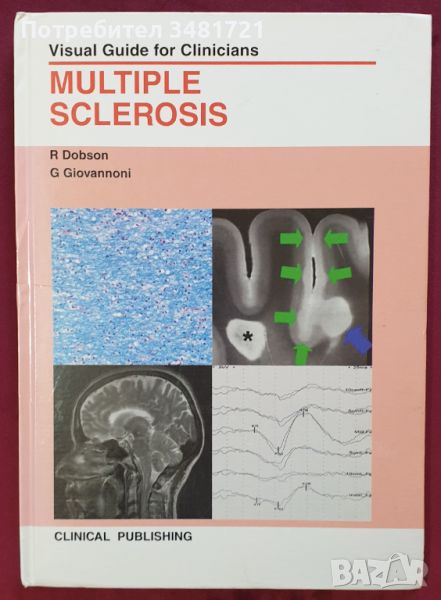 Множествена склероза - визуален справочник / Multiple Sclerosis - Visual Guide for Clinicians, снимка 1